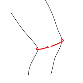 Knæstøtte fra Orliman (sort)